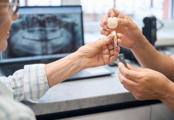 Dental Implants