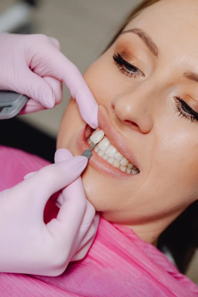 Teeth Cleaning