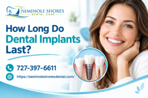 How Long Do Dental Implants Last