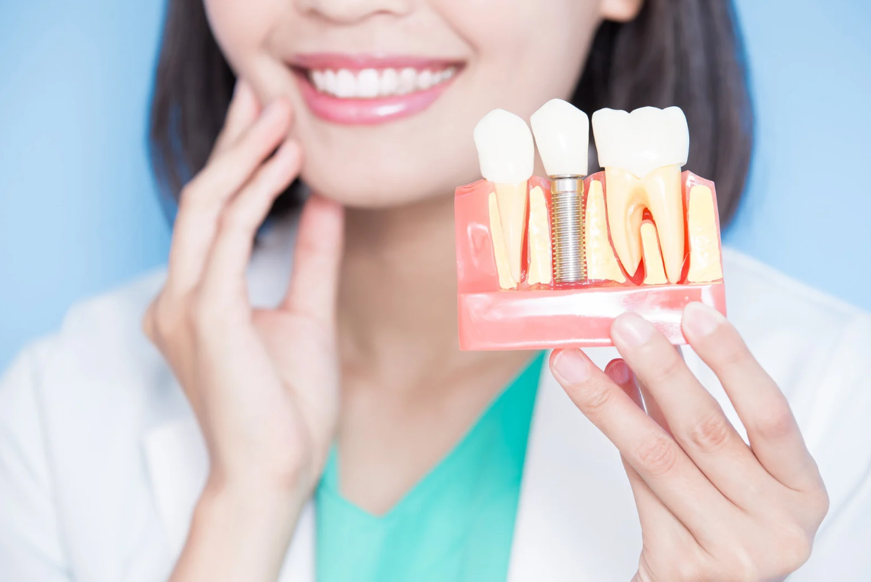 Are Dental Implants Worth the Investment?