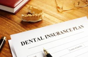 Does Dental Insurance Cover Veneers?