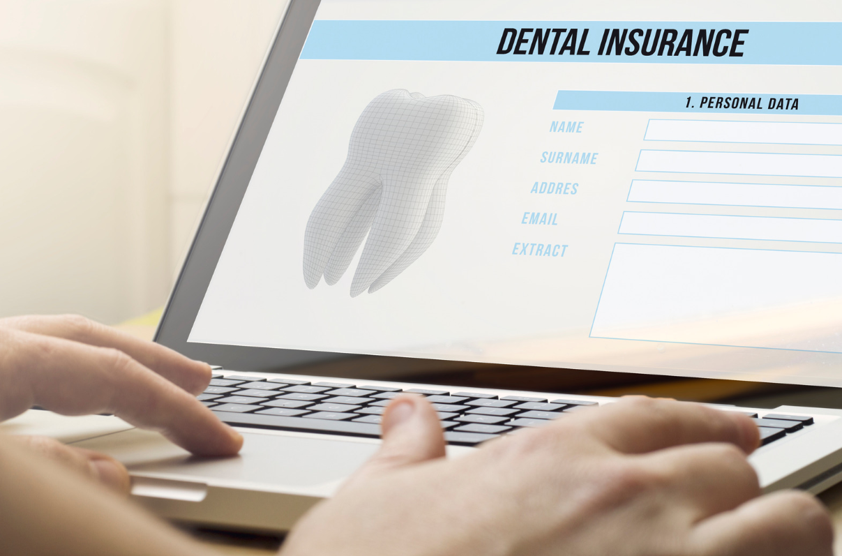 Does Dental Insurance Cover Veneers?