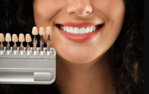 Are Dental Veneers Permanent?