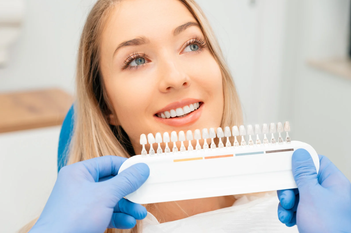 Are Dental Veneers Permanent?